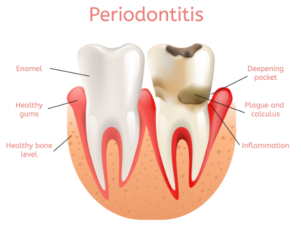 Periodontists
